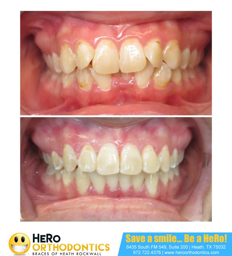 Review image from Jules Martinez 